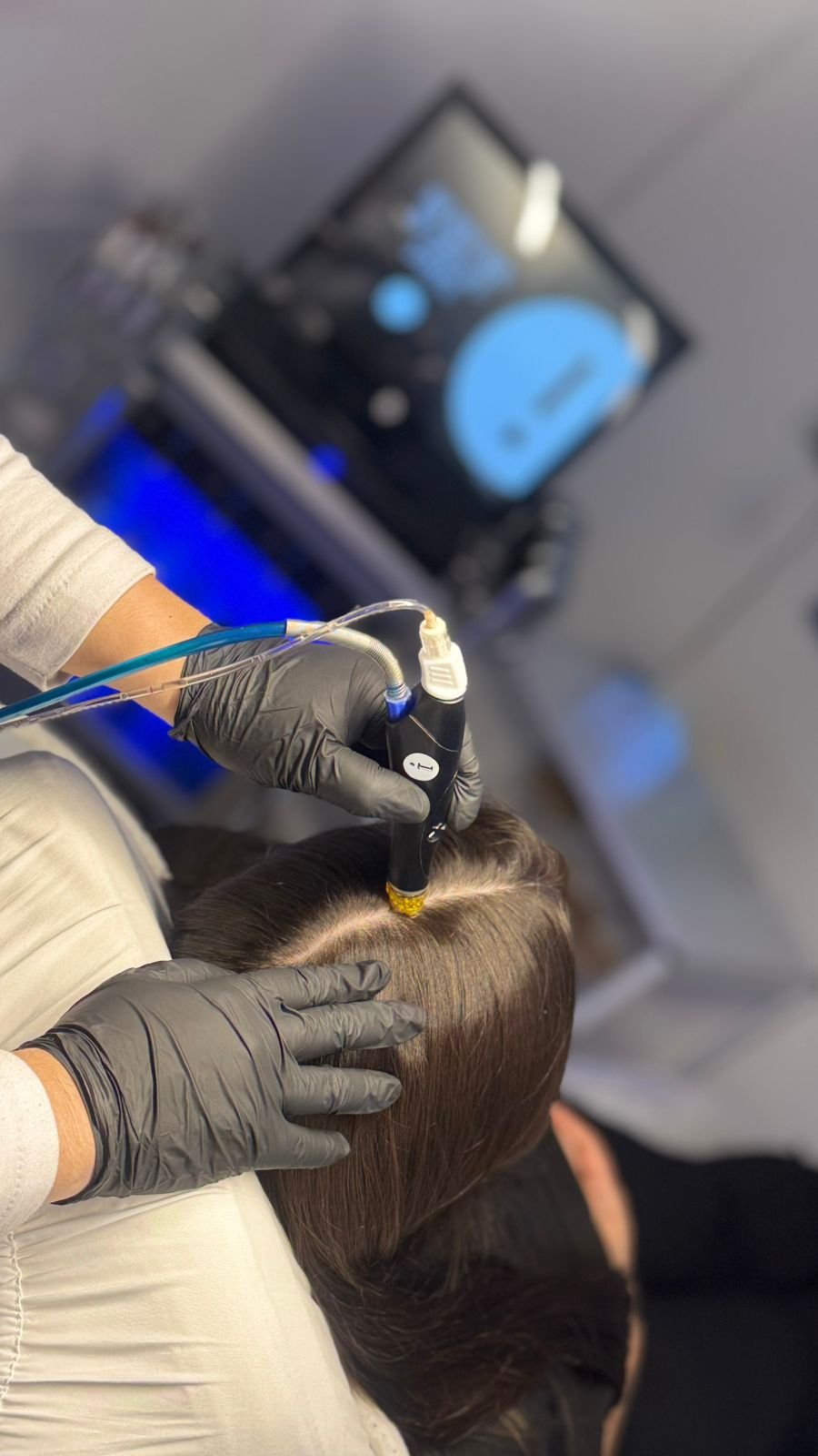 Tratamiento capilar con láser en PHI Médica